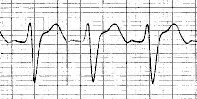 tcaecg7.jpg