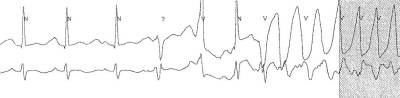 tdponset_1_300dpi.jpg